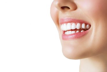 Teeth Whitening