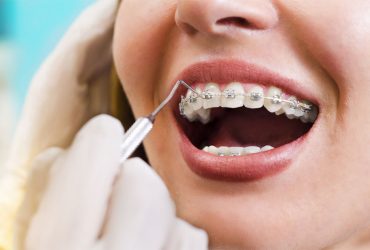 Orthodontics