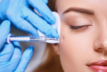 Glabella Botox