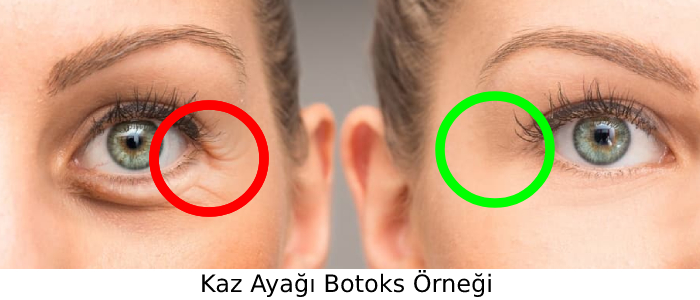 kaz_ayagi_botoks.afk